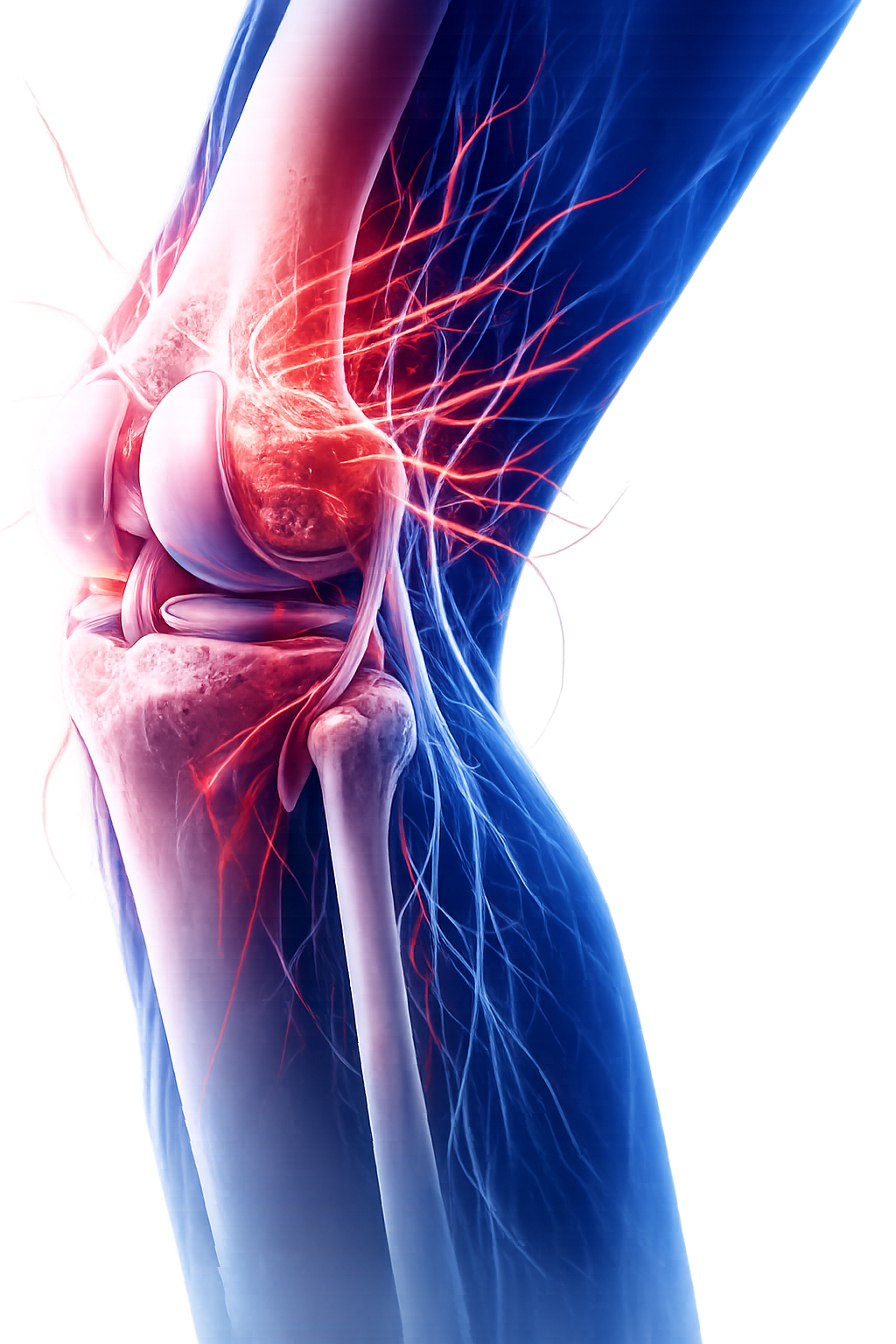 Expert Orthopaedic Knee Care
